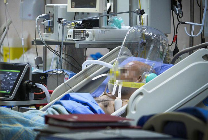 Novi uređaj umesto respiratora